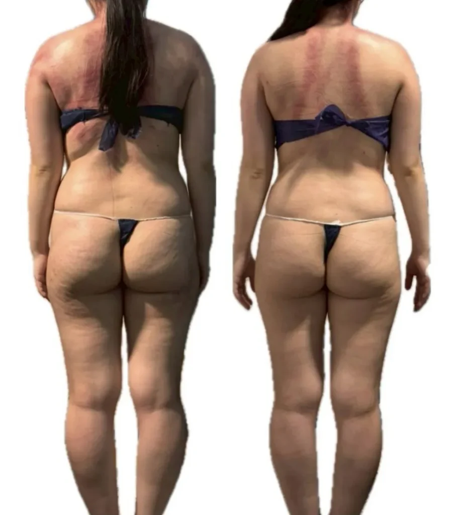 Before & After3