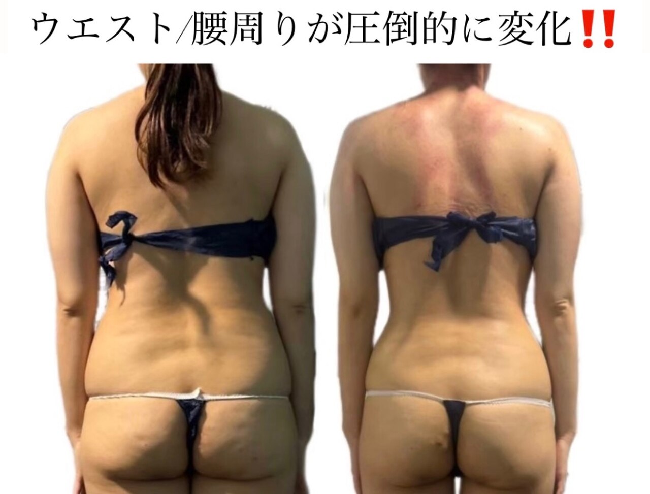 大宮痩身エステ実績データ