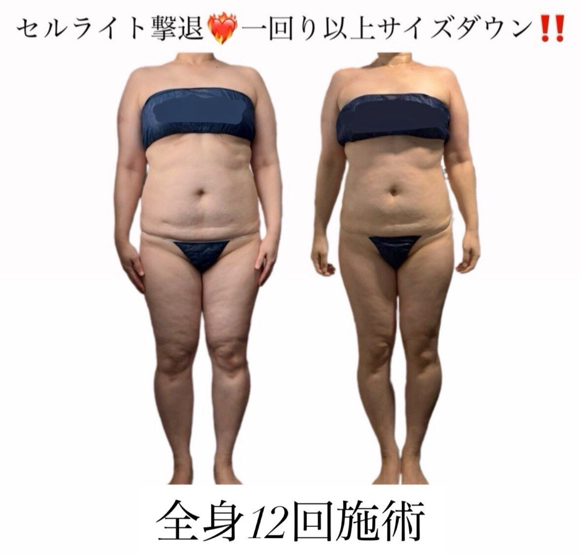 痩身革命大宮店の完全個室施術室